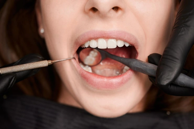 macro photography beautiful female smile with white healthy teeth 651396 3429