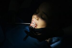 Young girl having a dental checkup before sealants are placed on her molars