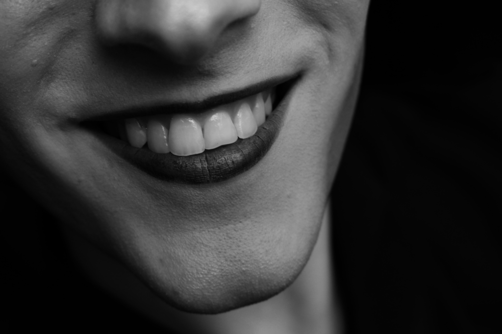 Close-up of front teeth checked for white spots at a Thornhill dental clinic