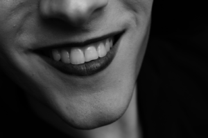 Close-up of front teeth checked for white spots at a Thornhill dental clinic